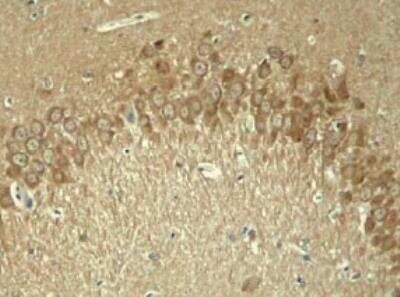 Immunohistochemistry-Paraffin: Tau [p Thr181] Antibody [NB100-82245]